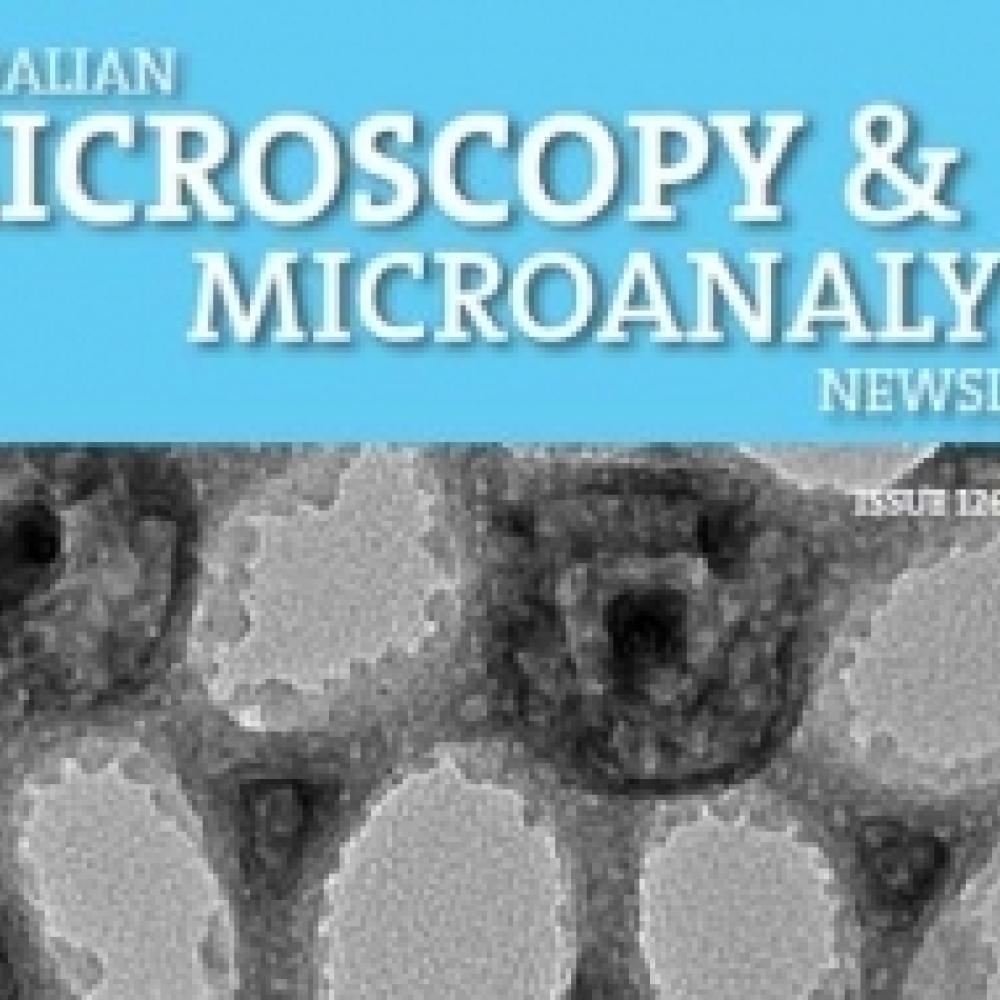 SEM image of 3DOM catalyst by Dr Hamid Arandiyan